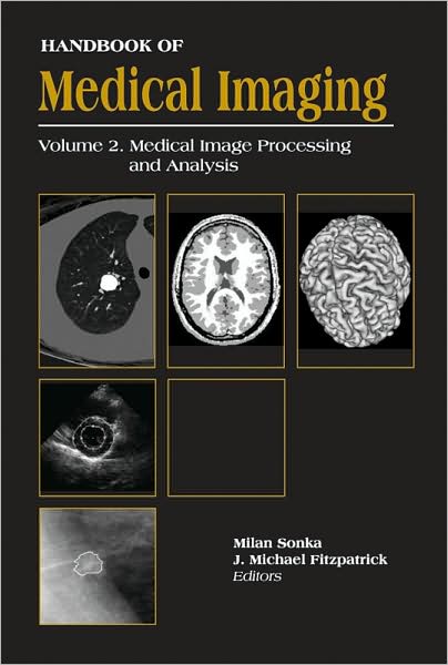 Handbook of Medical Imaging, Volume 2. Medical Image Processing and Analysis