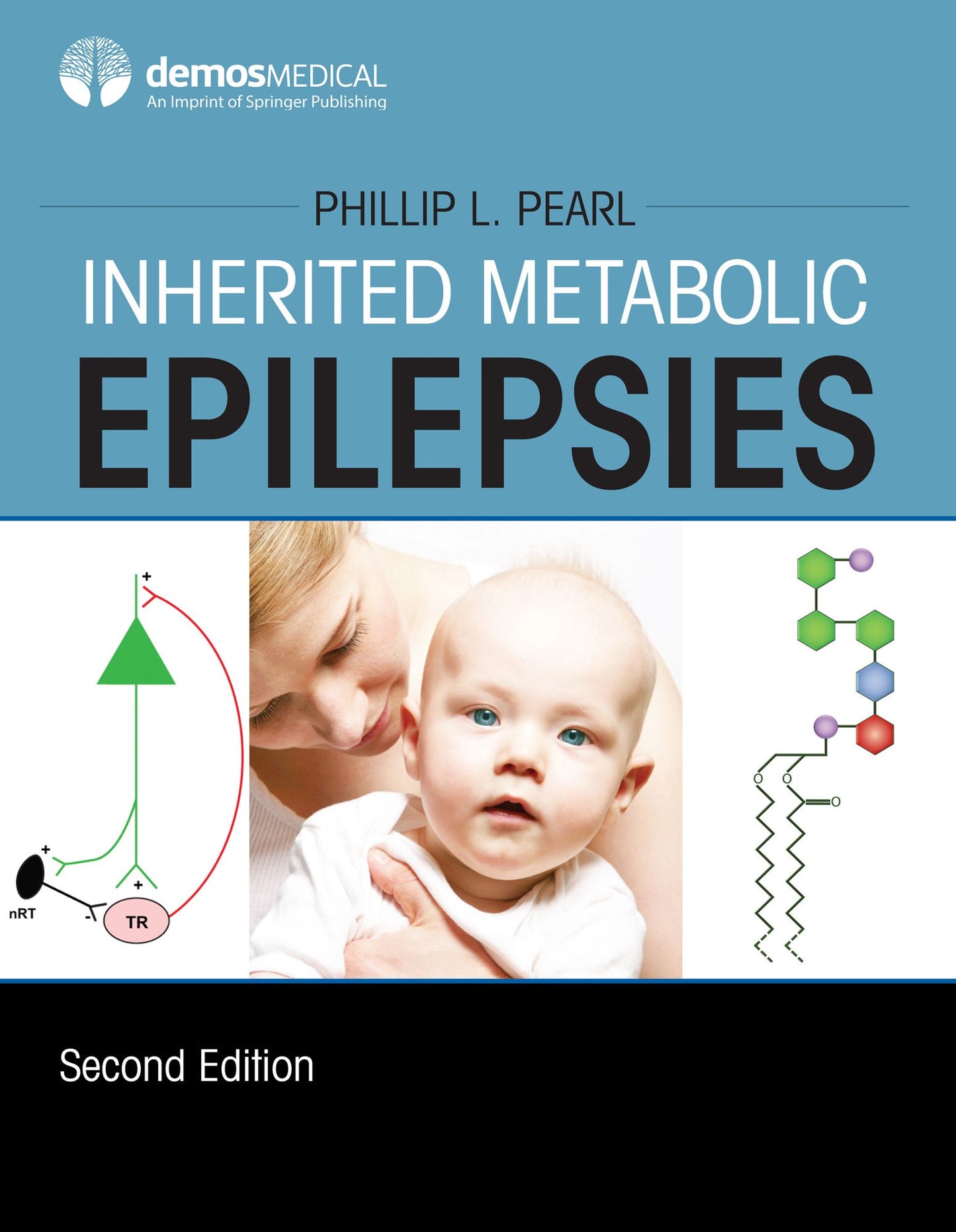 Inherited Metabolic Epilepsies