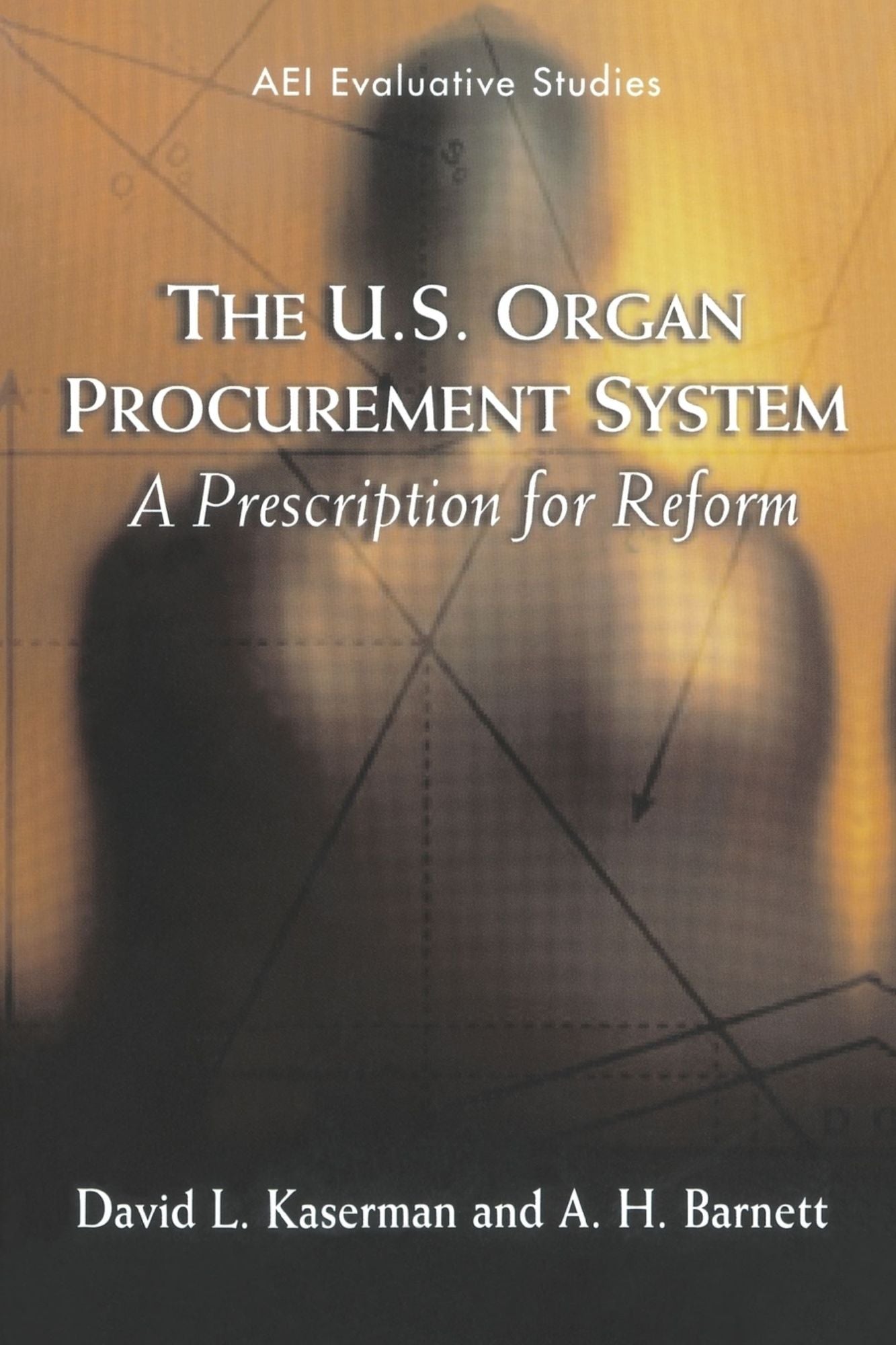 The U. S. Organ Procurement System: A Prescription for Reform