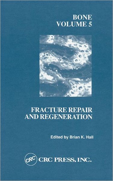 Bone, Volume V: A Treatise