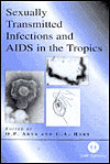 Sexually Transmitted Infections and AIDS in the Tropics