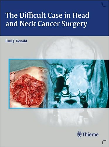 The Difficult Case in Head and Neck Cancer Surgery