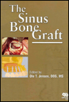 Sinus Bone Graft