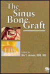 Sinus Bone Graft