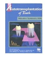 Autotransplantation Of Teeth