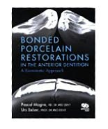 Bonded Porcelain Restorations in the Anterior Dentition: A Biomimetic Approach