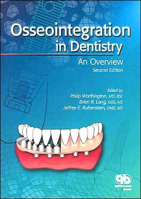 Osseointegration in Dentistry: An Overview