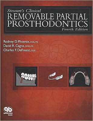 Stewart's Clinical Removable Partial Prosthodontics