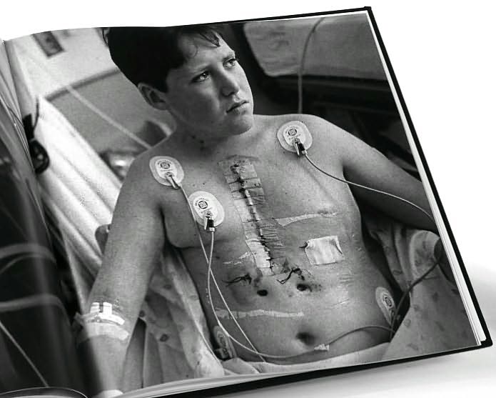 My Heart vs. the Real World: Children with Heart Disease, in Photographs and Interviews