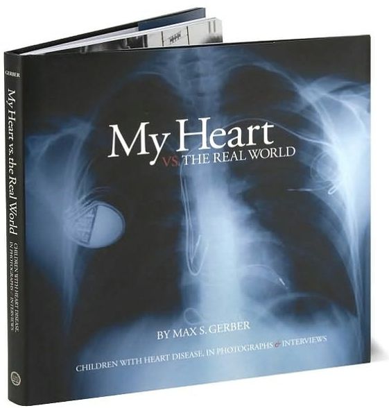 My Heart vs. the Real World: Children with Heart Disease, in Photographs and Interviews