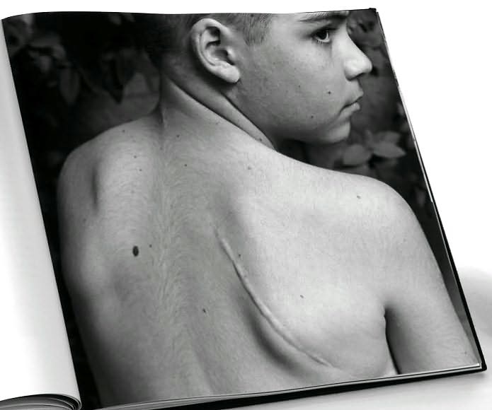 My Heart vs. the Real World: Children with Heart Disease, in Photographs and Interviews