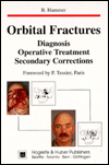 Orbital Fractures: Diagnosis, Operative Treatment, Secondary Corrections