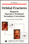 Orbital Fractures: Diagnosis, Operative Treatment, Secondary Corrections