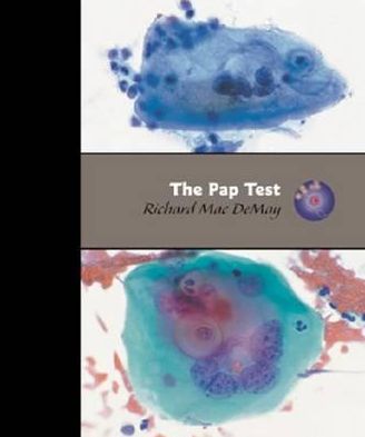 The Pap Test: Exfoliative Gynecologic Cytology