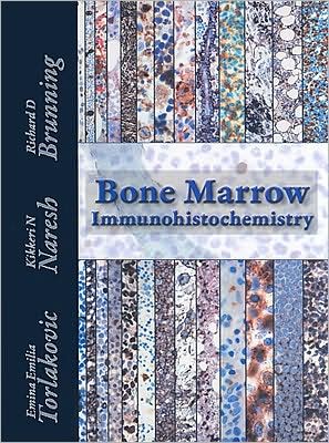 Bone Marrow IHC