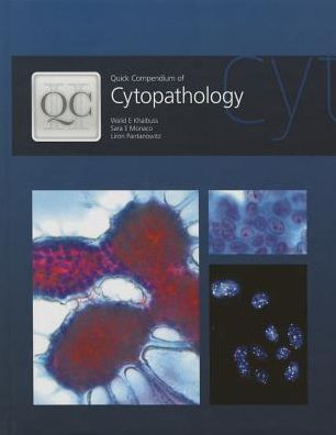 Quick Compendium of Cytopathology