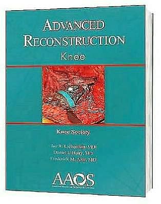 Advanced Reconstruction: Knee