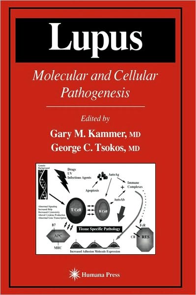 Lupus: Molecular and Cellular Pathogenesis