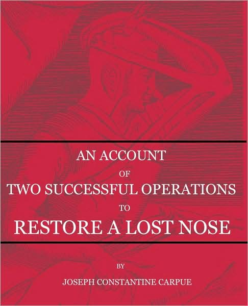 An Account Of Two Successful Operations For Restoring A Lost Nose