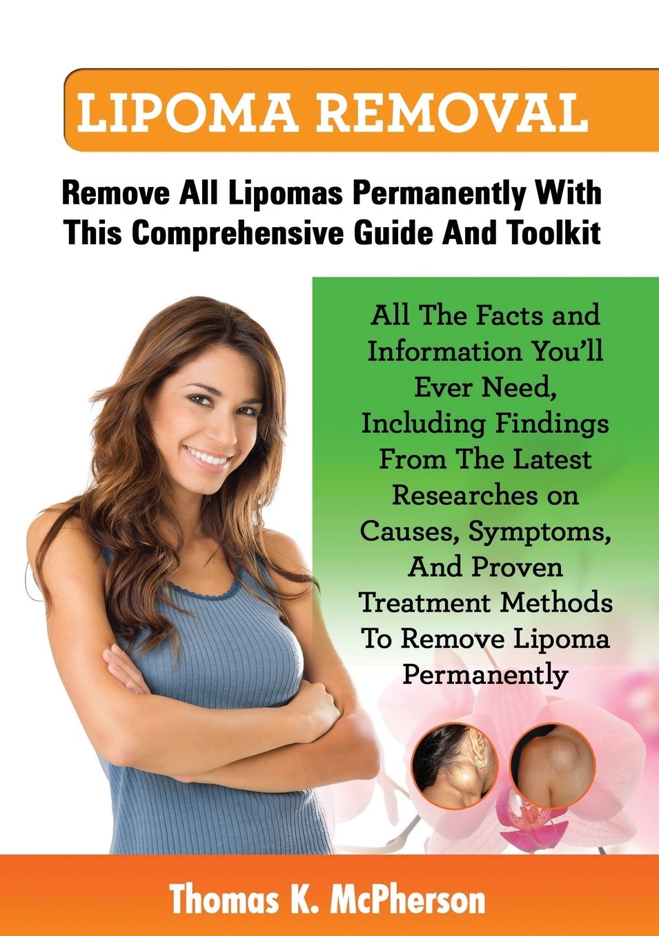 Lipoma Removal, Lipoma Removal Guide. Discover All the Facts and Information on Lipoma, Fatty Lumps, Painful Lipoma, Facial Lipoma, Breast Lipoma, Can
