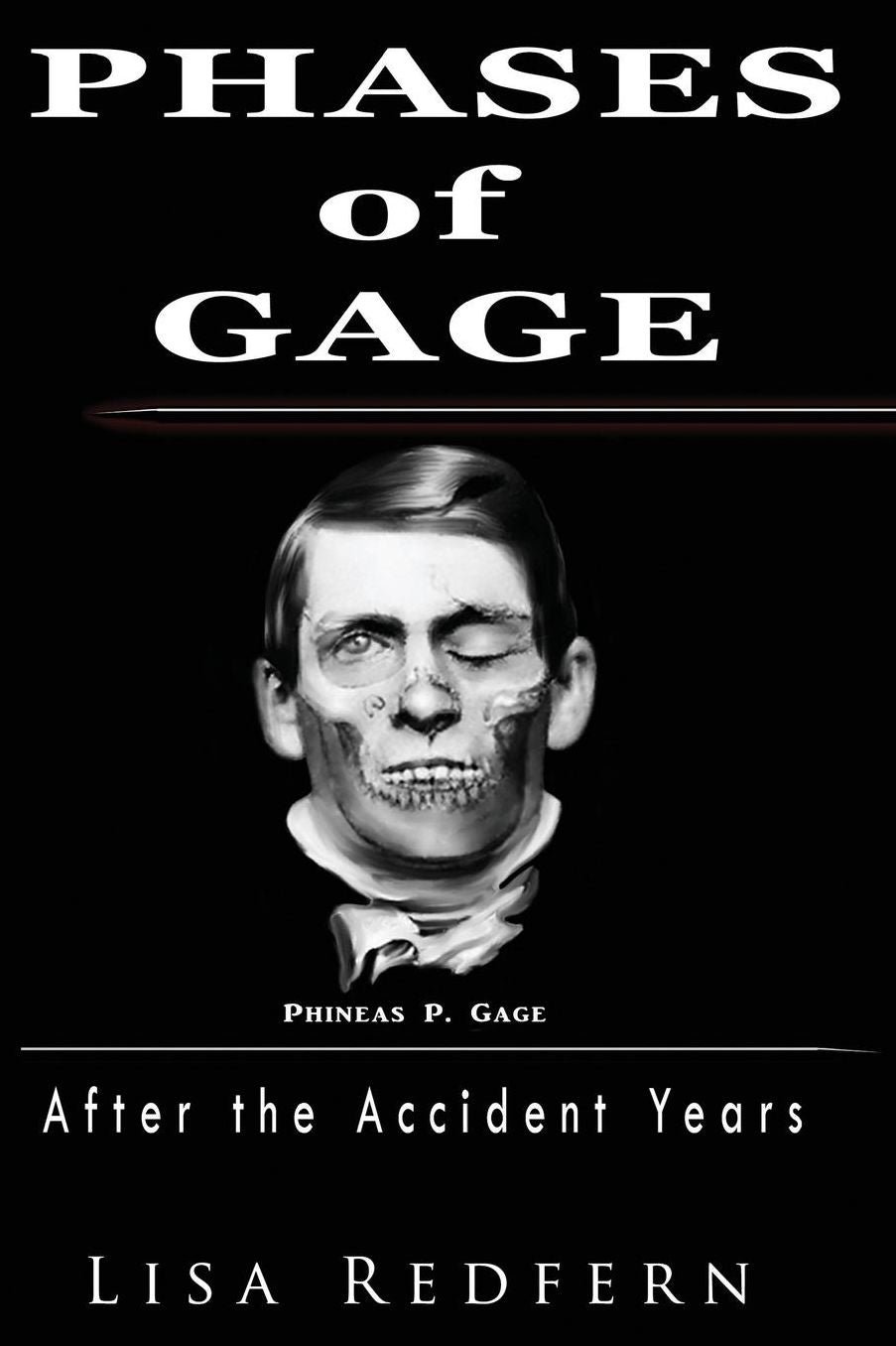 Phases of Gage: After the Accident Years