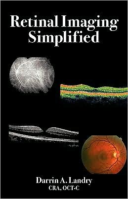 Retinal Imaging Simplified
