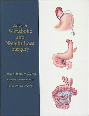 Atlas of Metabolic and Weight Loss Surgery