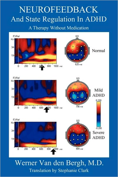 Neurofeedback And State Regulation In Adhd