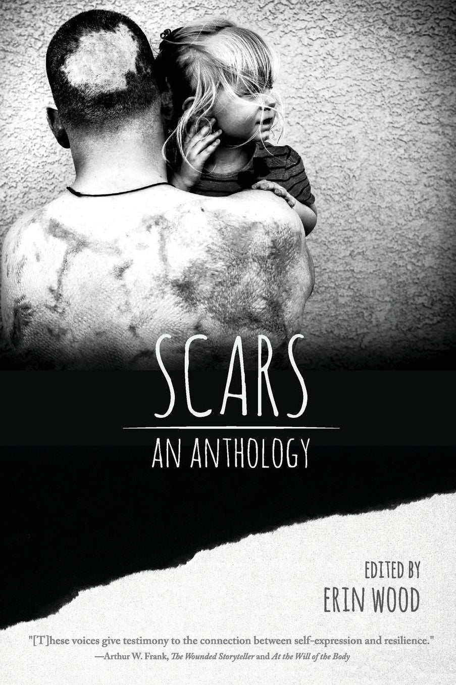 Scars: An Anthology