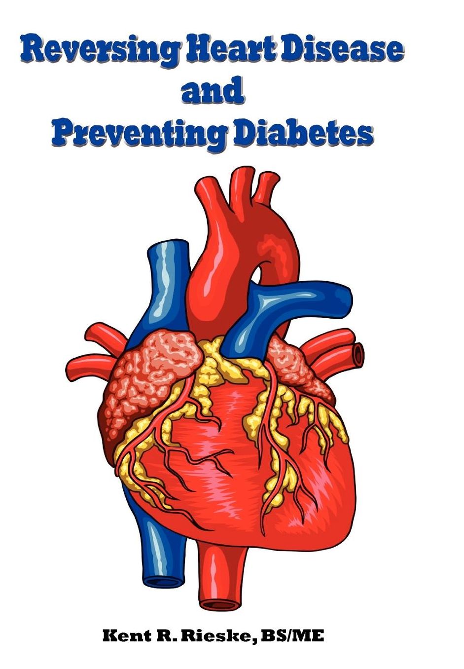 Reversing Heart Disease And Preventing Diabetes