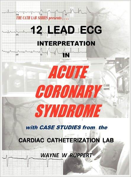 12 Lead Ecg Interpretation In Acute Coronary Syndrome With Case Studies From The Cardiac Catheterization Lab