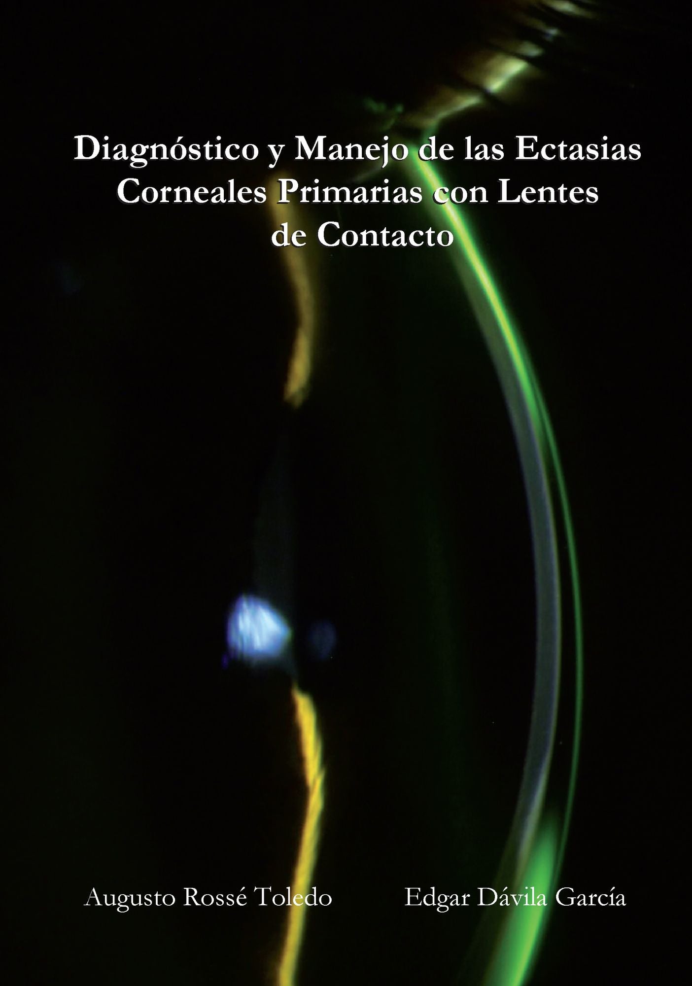 Diagnostico y Manejo de las Ectasias Corneales Primarias con Lentes de Contacto