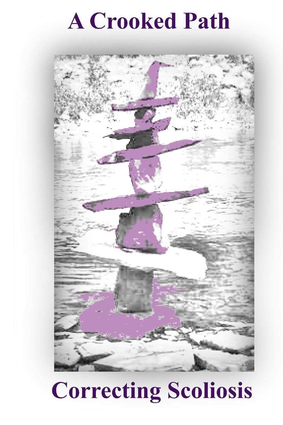 A Crooked Path: Correcting Scoliosis