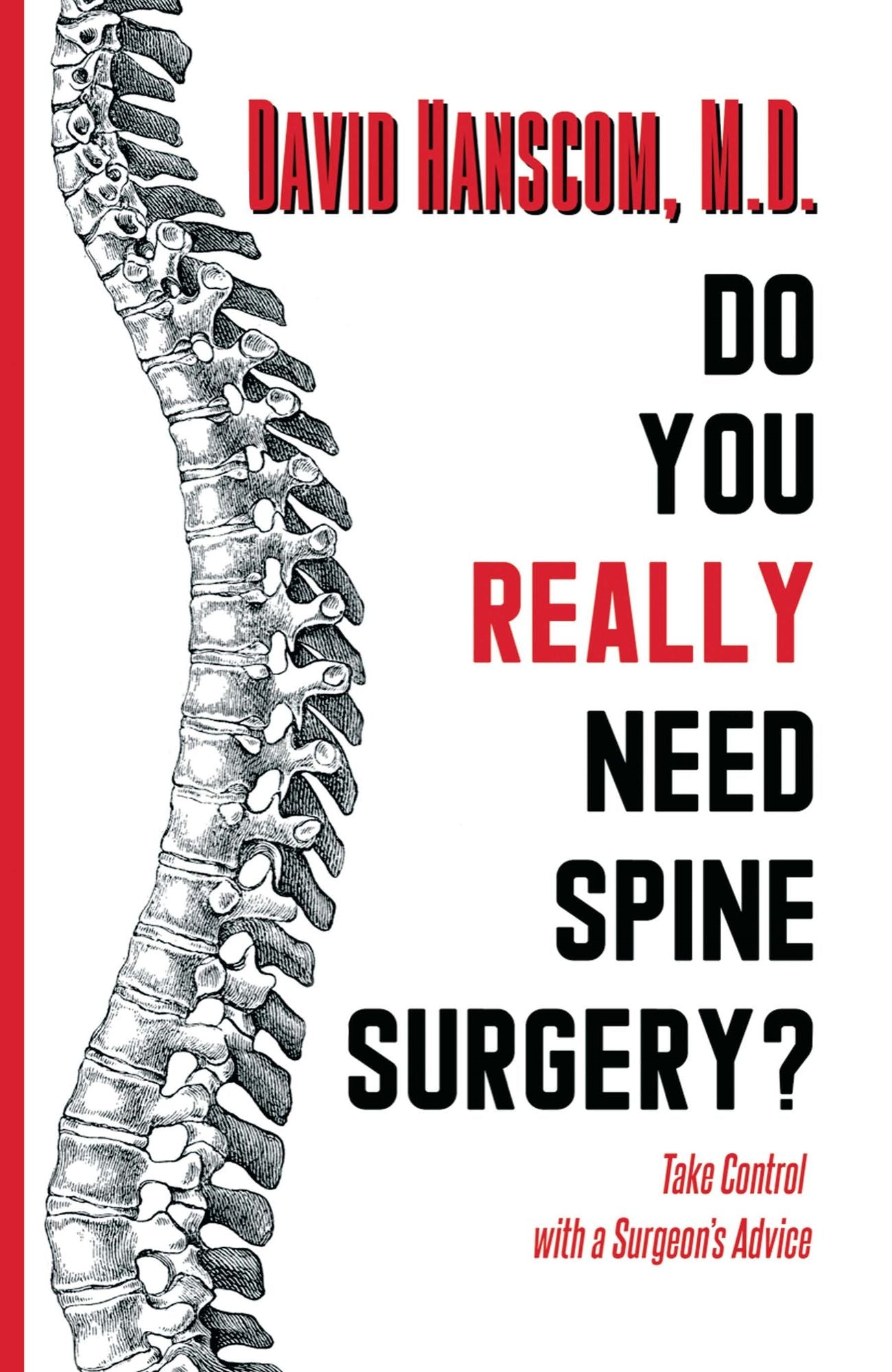 Do You Really Need Spine Surgery?: Take Control with a Spine Surgeon's Advice