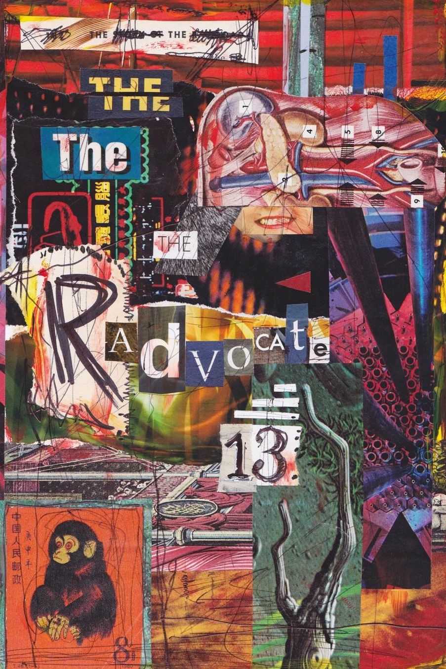 The Radvocate #13