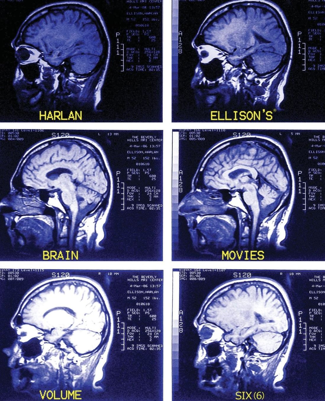 Brain Movies: The Original Teleplays of Harlan Ellison