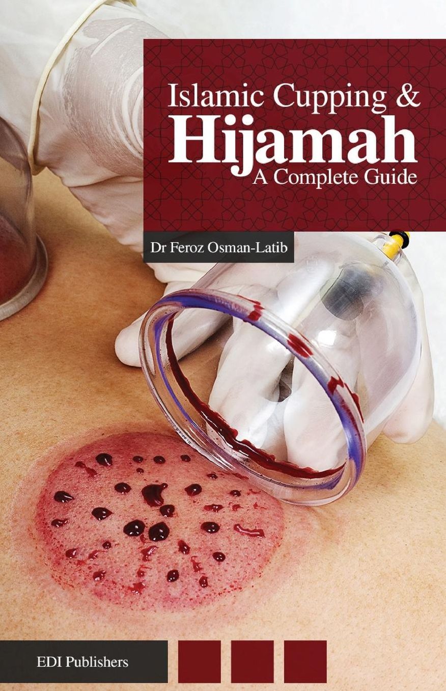 Islamic Cupping & Hijamah: A Complete Guide