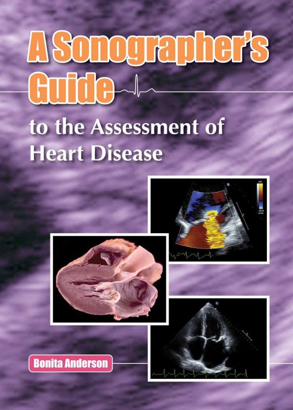 Sonographer's Guide to the Assessment of Heart Disease