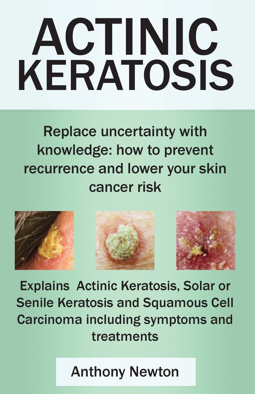 Actinic Keratosis. Replace the Fear and Uncertainty with Knowledge: How to Prevent Recurrence and Lower Your Skin Cancer Risk.