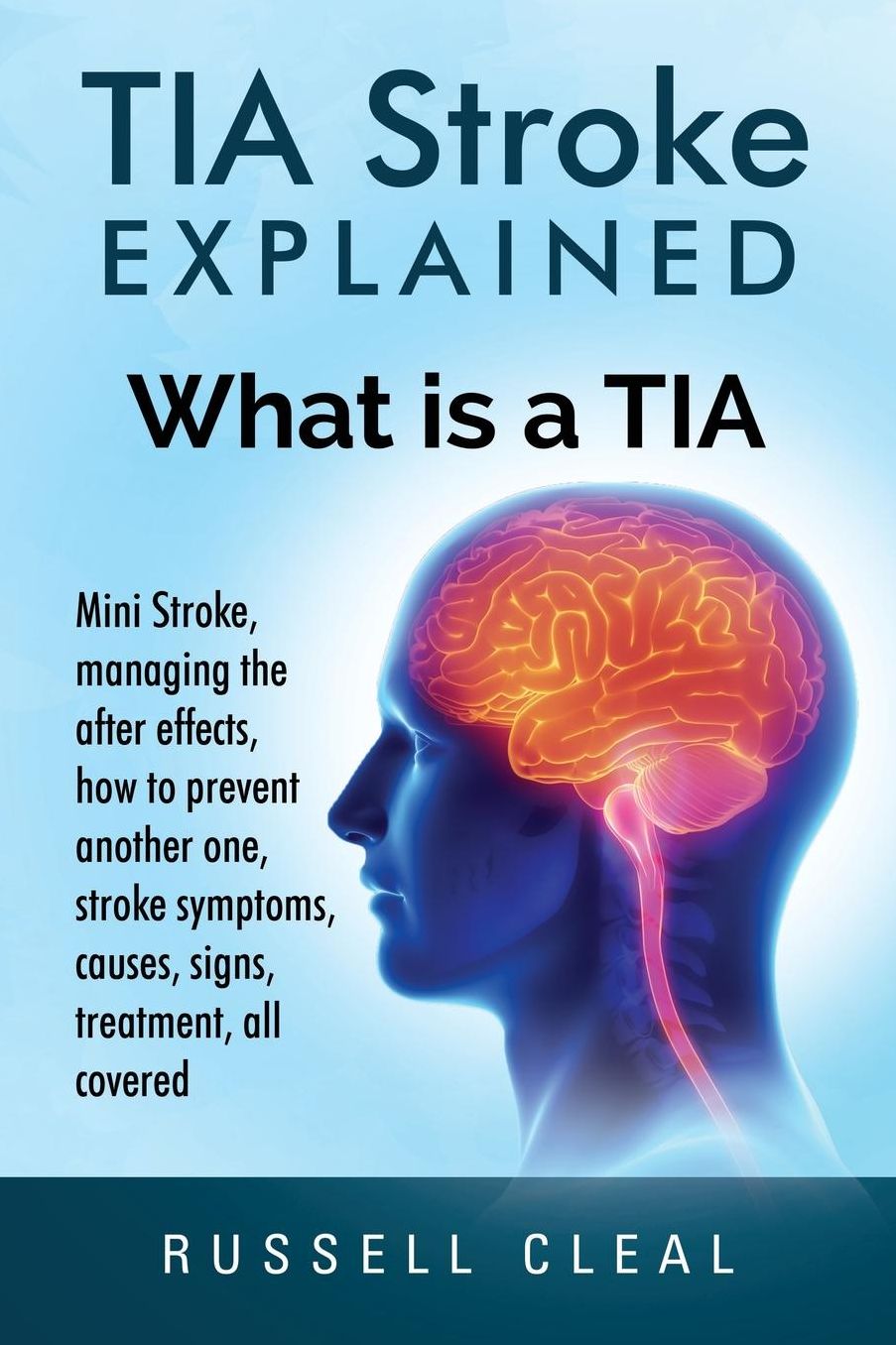 Tia Stroke Explained: What is a Tia, Mini Stroke, managing the after effects, how to prevent another one, stroke symptoms, causes, signs, treatment, all covered