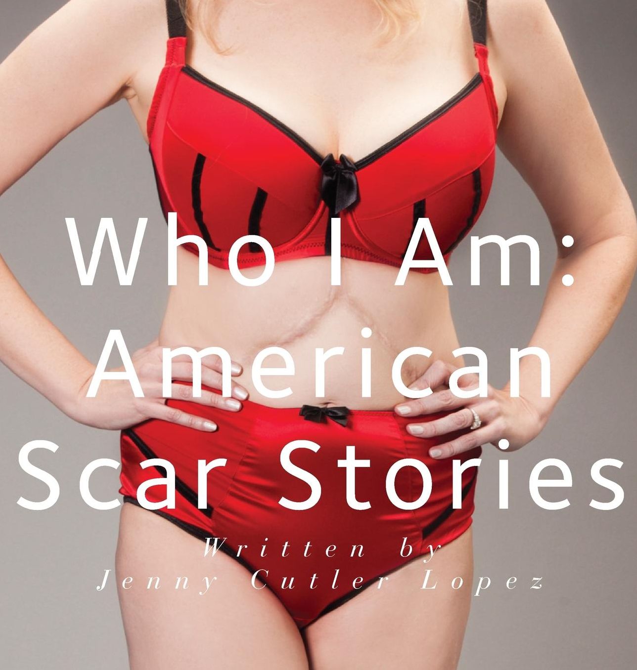 Who I Am: American Scar Stories