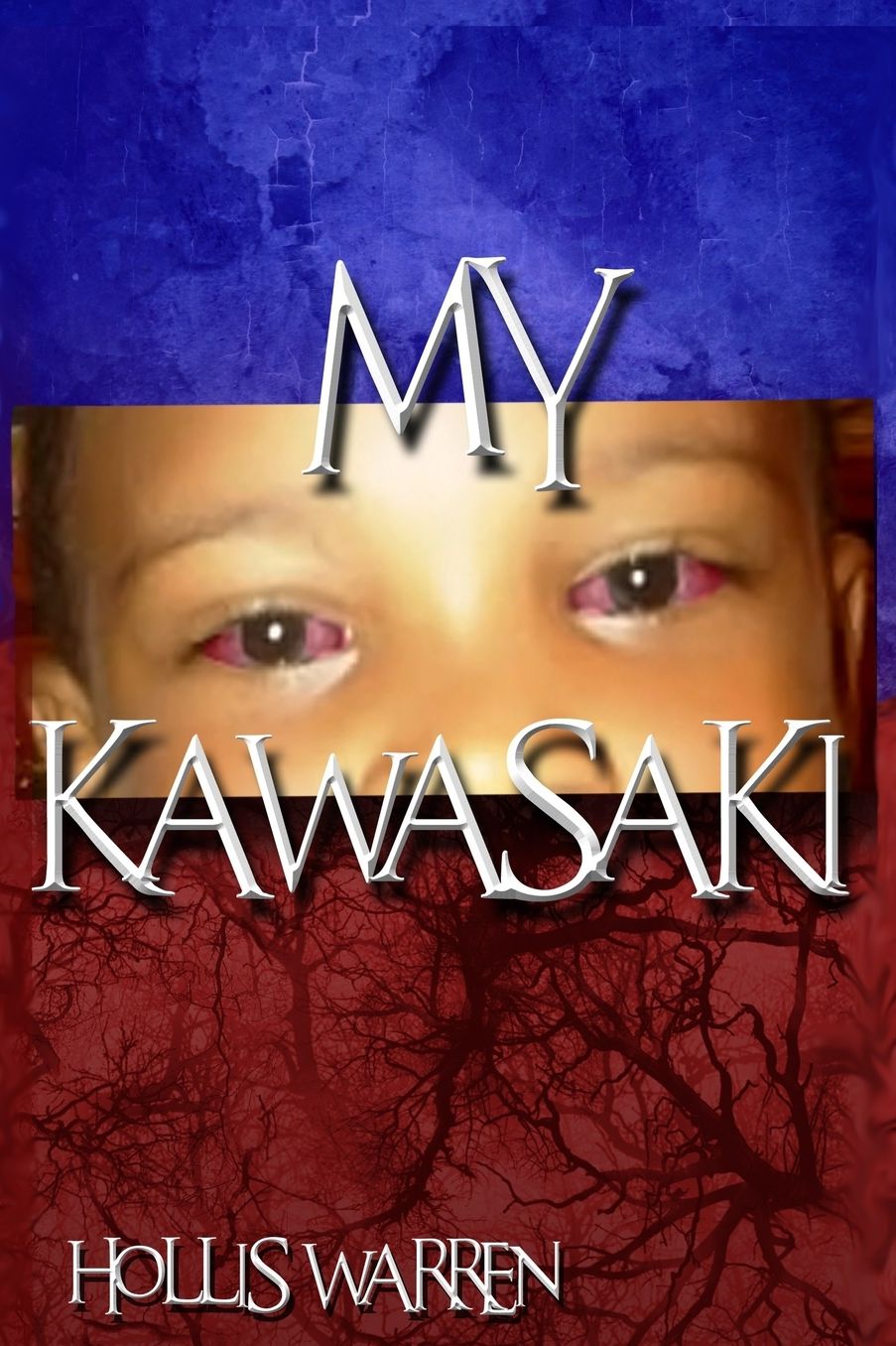 My Kawasaki