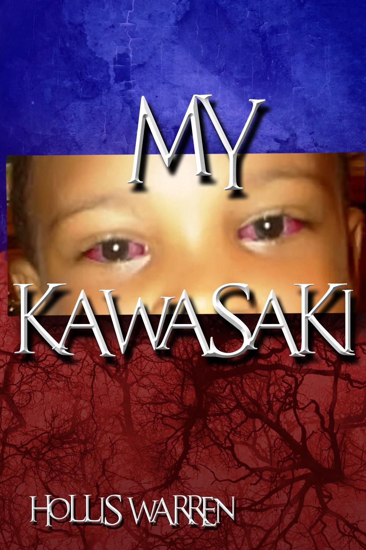 My Kawasaki