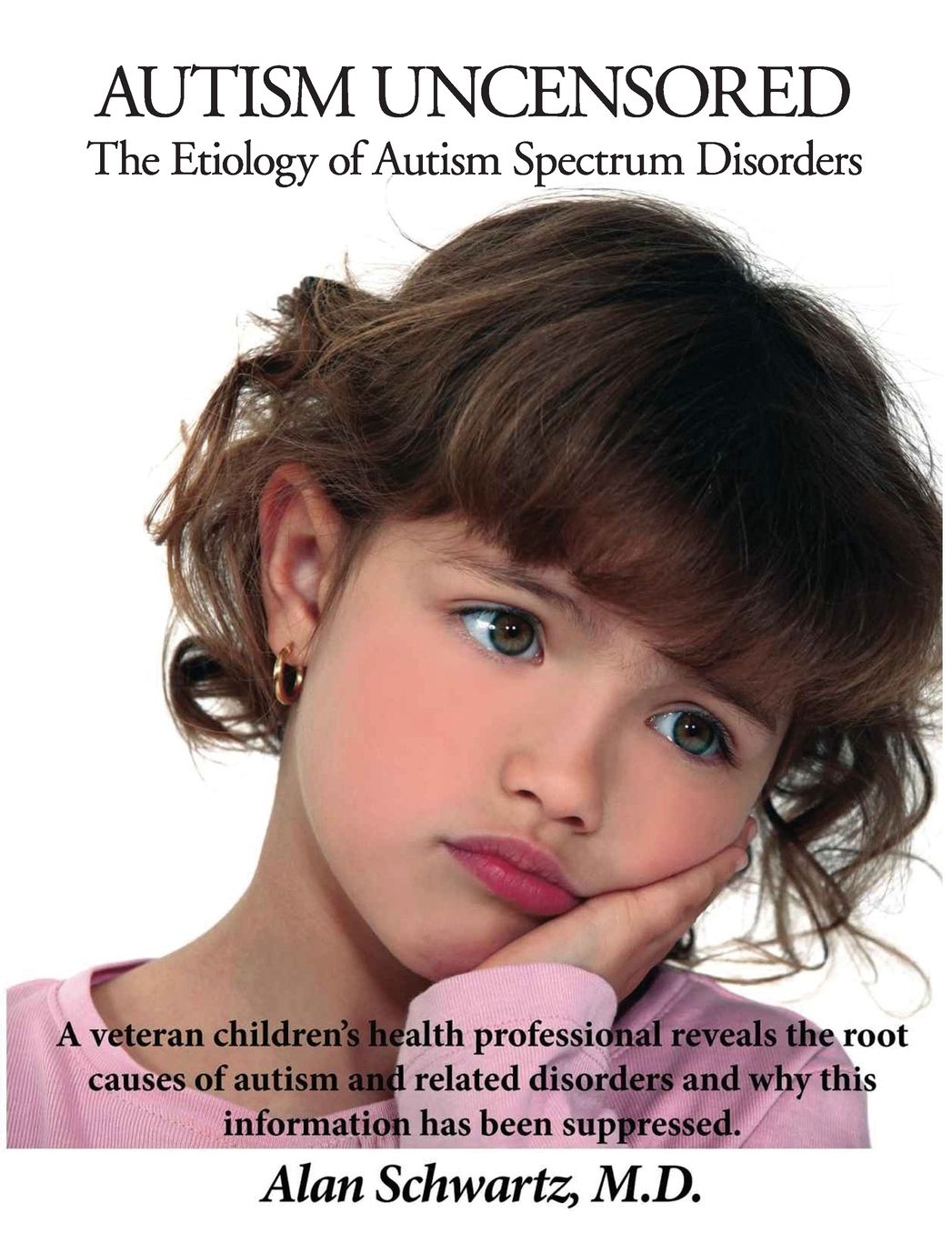 Autism Uncensored: The Etiology of Autism Spectrum Disorders