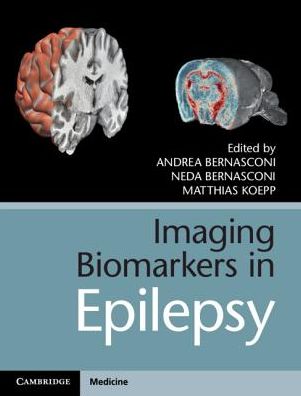 Imaging Biomarkers in Epilepsy