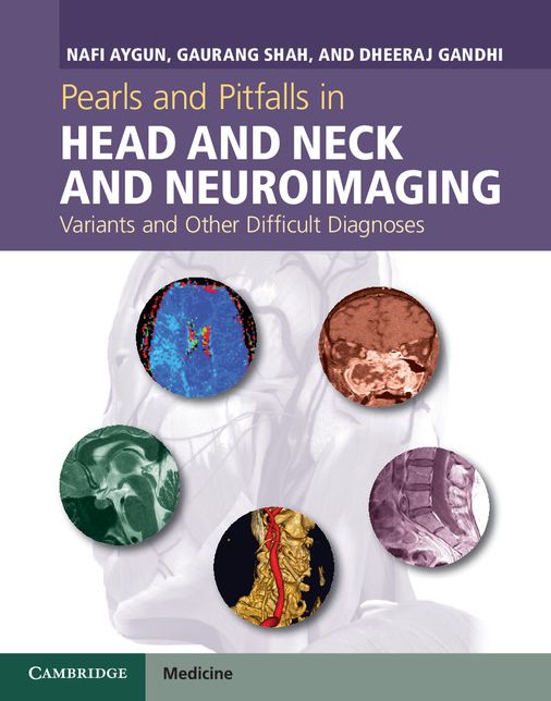 Pearls and Pitfalls in Head and Neck and Neuroimaging: Variants and Other Difficult Diagnoses