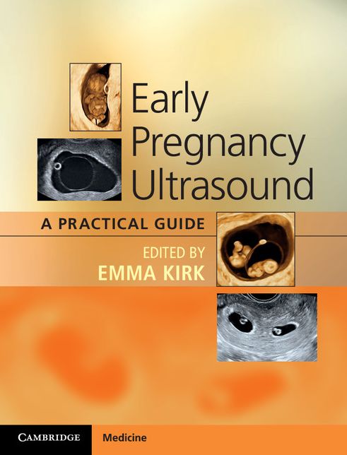 Early Pregnancy Ultrasound: A Practical Guide
