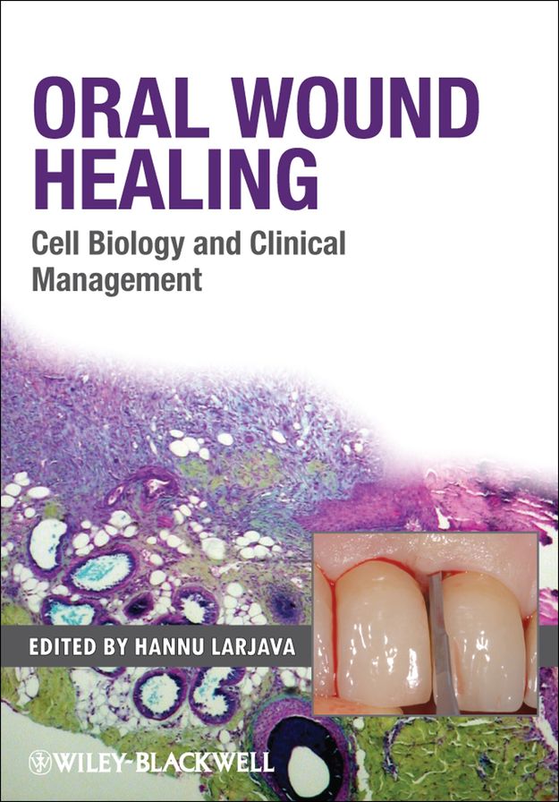 Oral Wound Healing: Cell Biology and Clinical Management
