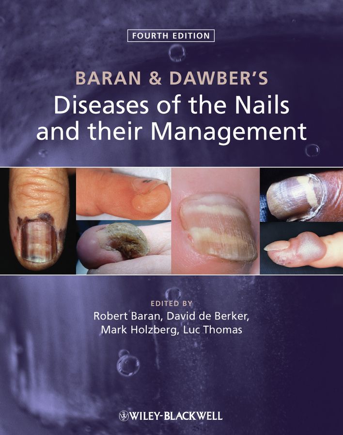 Baran and Dawber's Diseases of the Nails and their Management