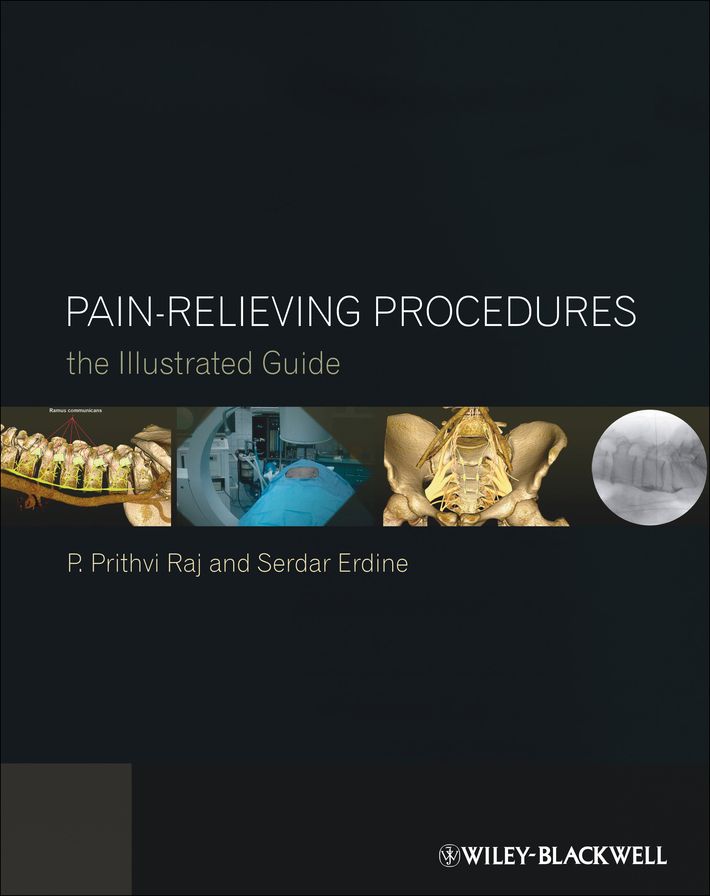 Pain-Relieving Procedures: The Illustrated Guide